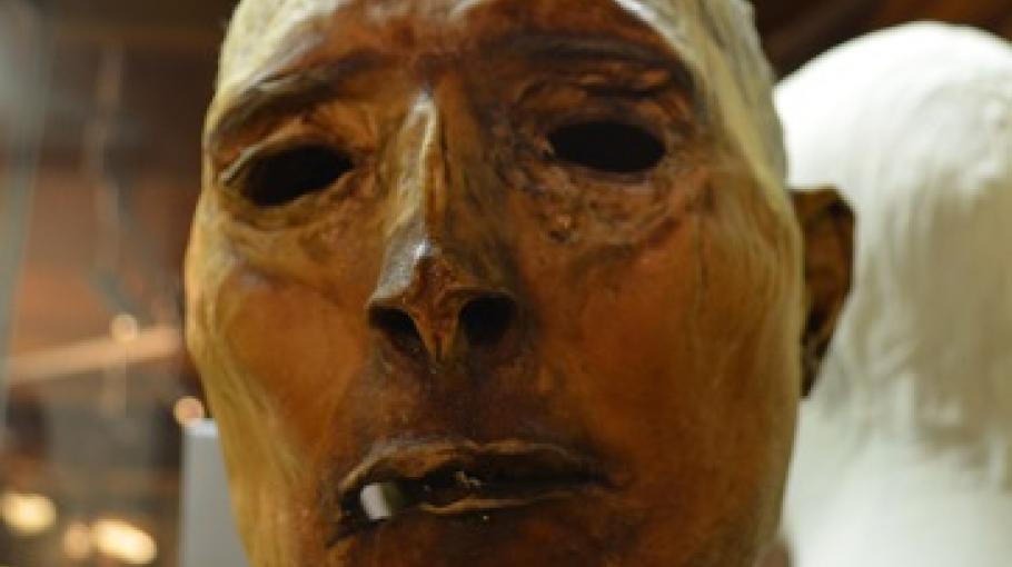 CC Benoît Prieur - Visage de Martin Dumollard reconstitué à partir de sa peau et de son cuir chevelu