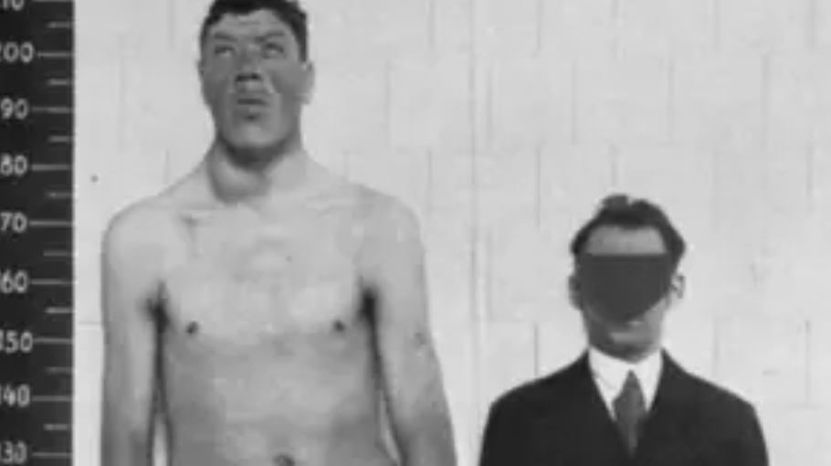 Adam Rainer après et avant sa poussée de croissance